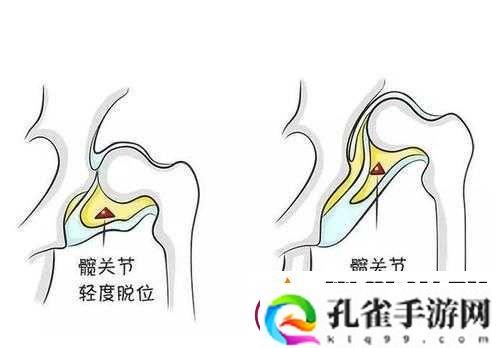 宝宝为什么要把腿抬起来靠墙上