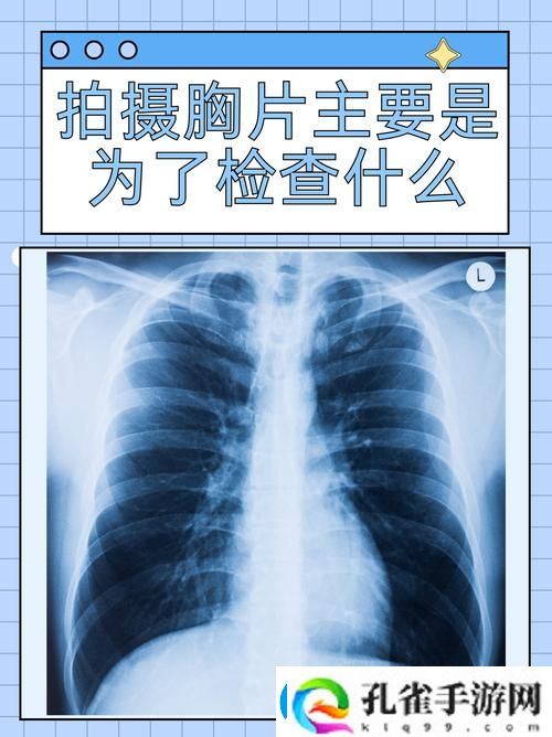 “100%胸片曝光率软件